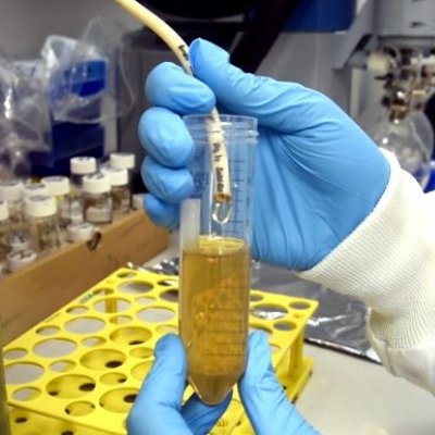 hands in blue gloves hold a small vial containing yellow liquid and white hose